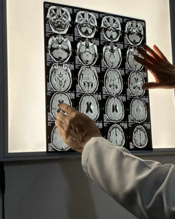 Person examining brain scan images on a lightbox