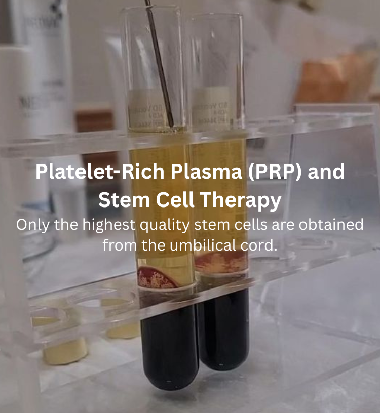 PRP stem cell