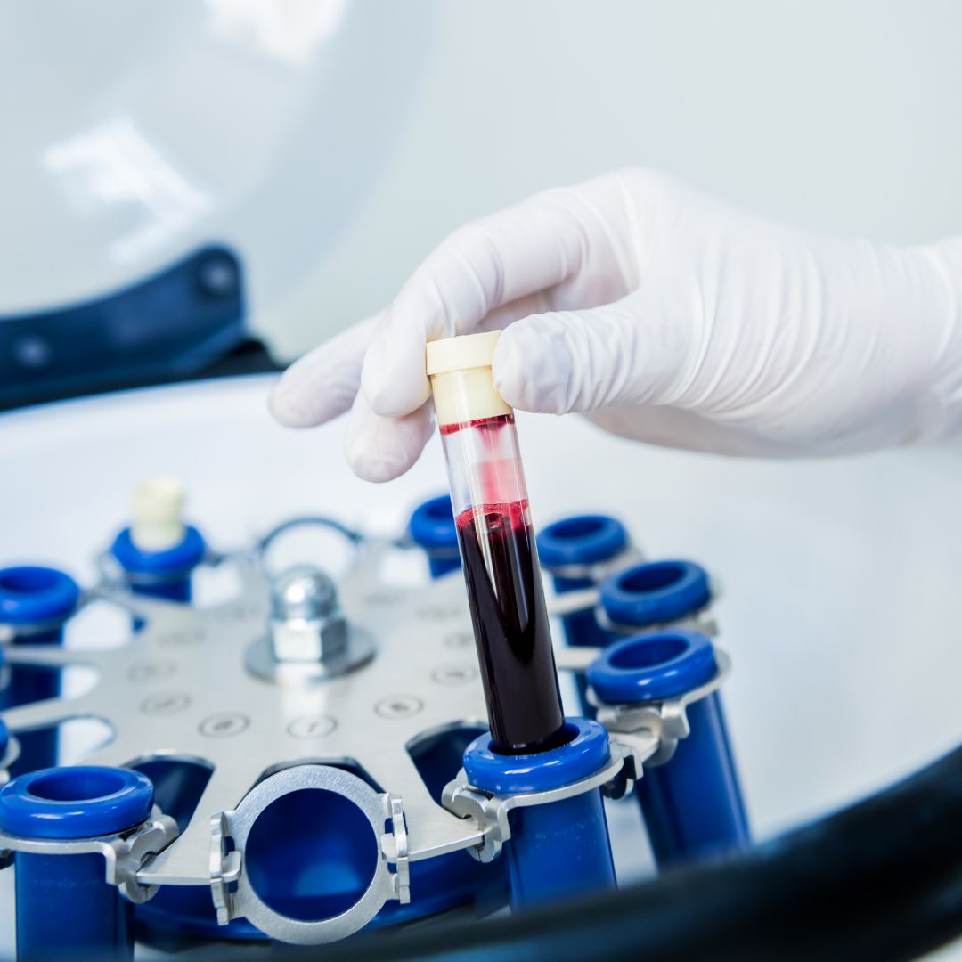 Hand holding a test tube with red liquid over a rack of test tubes in a laboratory setting